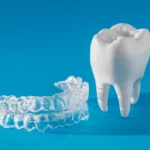 Aparat Invisalign Warszawa